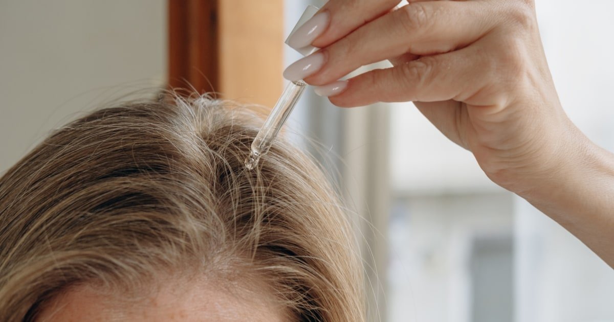Thinning hair? Don't panic